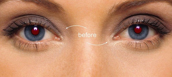 Nguyên nhân, cách khắc phục hiệu ứng 
